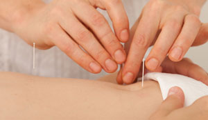 The gift of wellness through acupuncture
